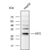 Solarbio K003203P Anti-IGF2 Rabbit Polyclonal Antibody