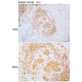 Solarbio K110339P Anti-SSX2IP Polyclonal Antibody