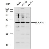 Solarbio K110303P Anti-POU4F3 Polyclonal Antibody