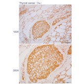 Solarbio K110362P Anti-CDO1 Polyclonal Antibody