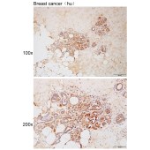 Solarbio K112163P Anti-ACE Polyclonal Antibody