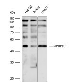 Solarbio K112254P Anti-GPBP1L1 Polyclonal Antibody