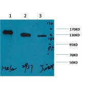 Solarbio K000212M Anti-PARP Monoclonal Antibody