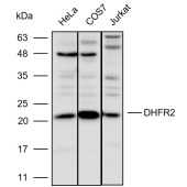 Solarbio K110502P Anti-DHFR2 Polyclonal Antibody