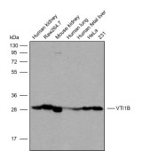 Solarbio K009821P Anti-VTI1B Polyclonal Antibody
