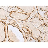 Solarbio K009845P Anti-IPO11 Polyclonal Antibody