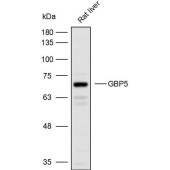 Solarbio K110380P Anti-GBP5 Polyclonal Antibody
