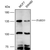 Solarbio K112166P Anti-PARD3 Polyclonal Antibody
