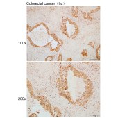 Solarbio K109928P Anti-RHOH Polyclonal Antibody