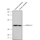 Solarbio K009852P Anti-ATP6V1C1 Polyclonal Antibody