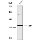 Solarbio K200077M Anti-TBP Monoclonal Antibody