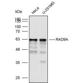 Solarbio K110001P Anti-RAD9A Polyclonal Antibody