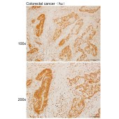 Solarbio K110089P Anti-LCK Polyclonal Antibody