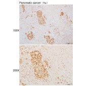 Solarbio K110072P Anti-DCX Polyclonal Antibody