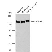 Solarbio K009827P Anti-CNTNAP2 Polyclonal Antibody