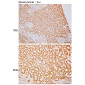 Solarbio K110351P Anti-DPP8 Polyclonal Antibody