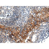 Solarbio K008218P Anti-CDH3 Polyclonal Antibody