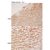 Solarbio K112187P Anti-NPHP4 Polyclonal Antibody