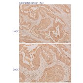 Solarbio K110386P Anti-AKTIP Polyclonal Antibody