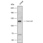 Solarbio K112196P Anti-NACAD Polyclonal Antibody