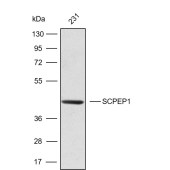 Solarbio K009803P Anti-SCPEP1 Polyclonal Antibody
