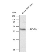Solarbio K009877P Anti-DPYSL4 Polyclonal Antibody