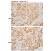 Solarbio K110095P Anti-G3BP1 Polyclonal Antibody