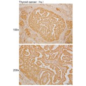 Solarbio K110026P Anti-TRIM17 Polyclonal Antibody