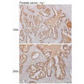 Solarbio K110495P Anti-NETO2 Polyclonal Antibody