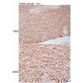 Solarbio K112183P Anti-GPRASP1 Polyclonal Antibody
