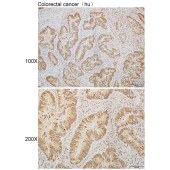 Solarbio K110280P Anti-RSPO1 Polyclonal Antibody