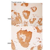 Solarbio K112232P Anti-ABHD5 Polyclonal Antibody