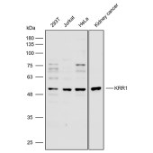 Solarbio K112310P Anti-KRR1 Polyclonal Antibody