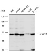 Solarbio K112256P Anti-ANGEL2 Polyclonal Antibody