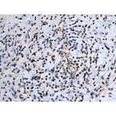 Solarbio K009840P Anti-PSMB3 Polyclonal Antibody