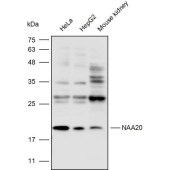 Solarbio K110399P Anti-NAA20 Polyclonal Antibody