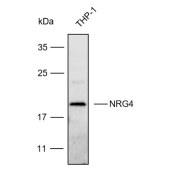 Solarbio K112312P Anti-NRG4 Polyclonal Antibody