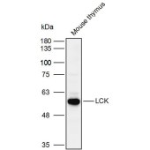 Solarbio K110089P Anti-LCK Polyclonal Antibody