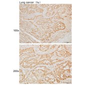 Solarbio K110021P Anti-LPCAT1 Polyclonal Antibody