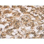 Solarbio K009901P Anti-GAS7 Polyclonal Antibody