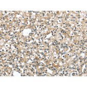 Solarbio K009806P Anti-SRP54 Polyclonal Antibody