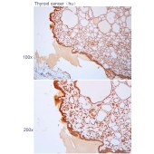 Solarbio K112220P Anti-SLC25A46 Polyclonal Antibody