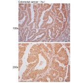 Solarbio K110374P Anti-TUBGCP3 Polyclonal Antibody