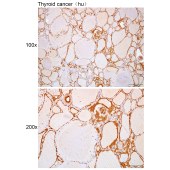 Solarbio K112311P Anti-FKBP2 Polyclonal Antibody