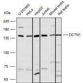 Solarbio K110404P Anti-DCTN1 Polyclonal Antibody