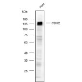 Solarbio K003569P Anti-CADH2 Polyclonal Antibody