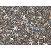 Solarbio K009870P Anti-IDI2 Polyclonal Antibody