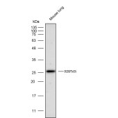 Solarbio K112282P Anti-RBPMS Polyclonal Antibody