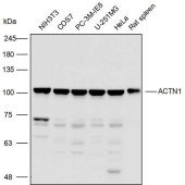 Solarbio K110498P Anti-ACTN1 Polyclonal Antibody