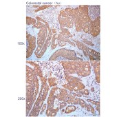 Solarbio K112207P Anti-COL4A2 Polyclonal Antibody